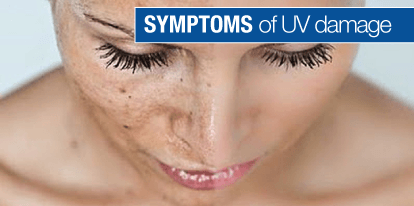 Symptoms of UV Damage